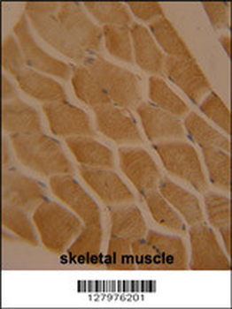 LMOD2 Antibody (N-term)