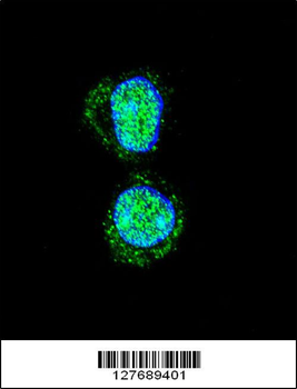 HOXA10 Antibody (Center)