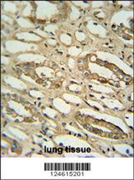 GGTLC2 Antibody (Center)