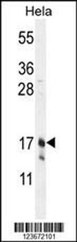 CLDN7 Antibody (C-term)