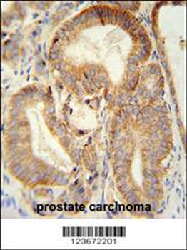 CLDN7 Antibody (C-term)