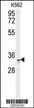 AKR1C3 Antibody (N-term)