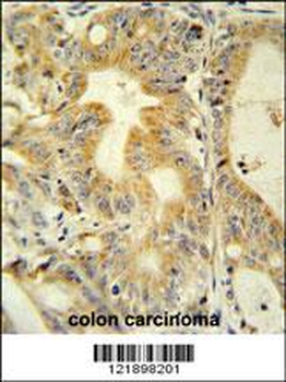 TNFRSF6B Antibody (N-term)