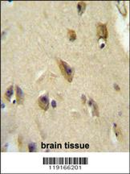APOL6 Antibody (Center)