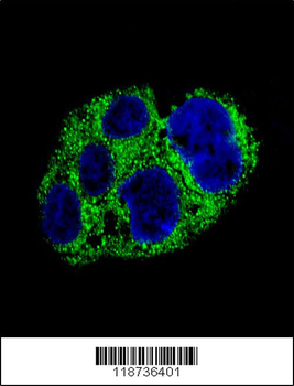 AMACR Antibody (C-term)