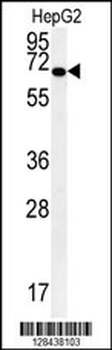 KEAP1 Antibody (C-term)