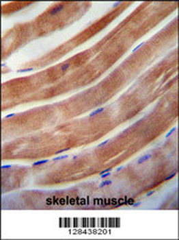 KEAP1 Antibody (C-term)