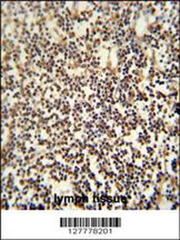 PARPBP Antibody (C-term)