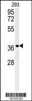 LGALS9B Antibody (Center)