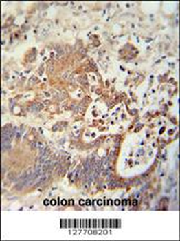 CHCHD2 Antibody (Center)
