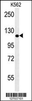 POTEE Antibody (Center)