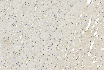 PARK8 (LRRK2) Antibody
