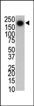 PARK8 (LRRK2) Antibody