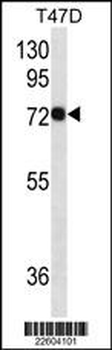 CD138 Antibody