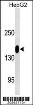 ANPEP/CD13 Antibody