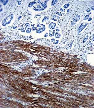 ACTA1 Antibody