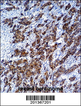 LGALS3 Antibody (C-term)