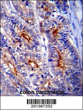 LGALS3 Antibody (C-term)