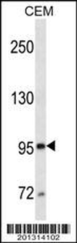 MME/CD10 Antibody