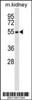 RPS6KL1 Antibody