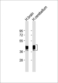 GFAP Antibody