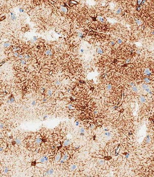 GFAP Antibody