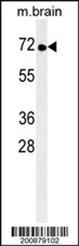 TNK1 Antibody