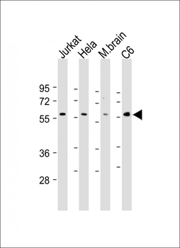 AKT2 Antibody