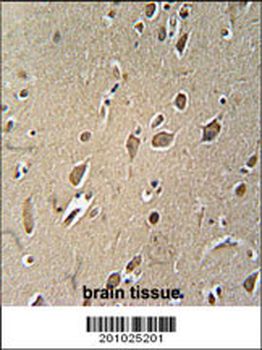 NGFR Antibody
