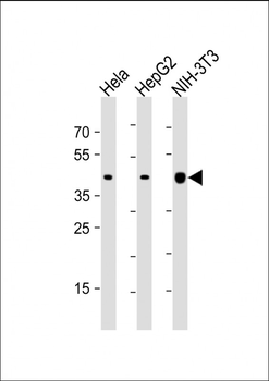Beta-Actin Antibody