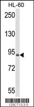 BRAF Antibody