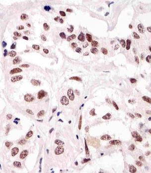 SUMO1 Antibody