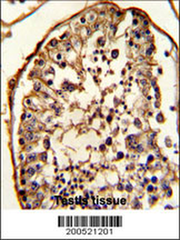 TBB5 Antibody