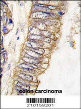 MET/HGFR Antibody