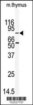 MARK2 (EMK) Antibody (C-term)