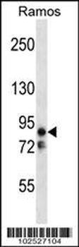 MARK2 (EMK) Antibody (C-term)