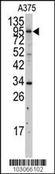 MYLK3 Antibody (N-term)