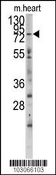 MYLK3 Antibody (N-term)