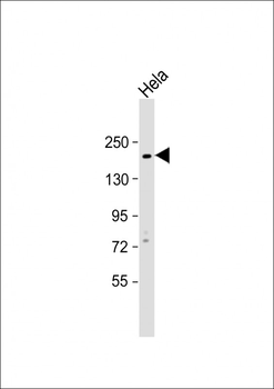 KIT Antibody (N-term D121)