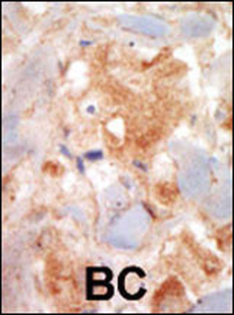 c-KIT Antibody (N-term)