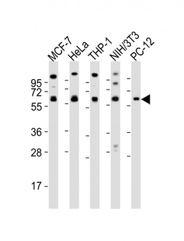Pyruvate Kinase (PKM2) Antibody (N-term)
