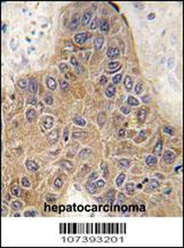 STUB1 Antibody (C-term)