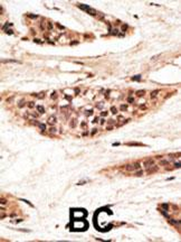 TAP1 Antibody (C-term)