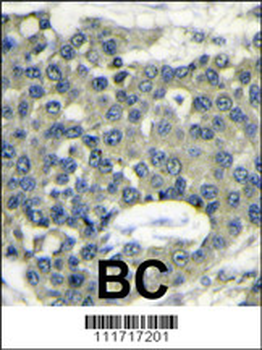 EIF4B Antibody (C-term)