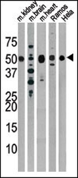 Drosophila Parkin Antibody (N-term)