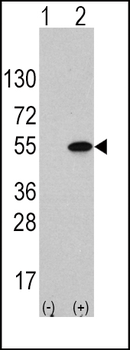 ATF4 Antibody (S245)