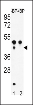 ATF4 Antibody (S245)