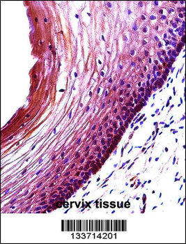 BBC3 Antibody (Center)