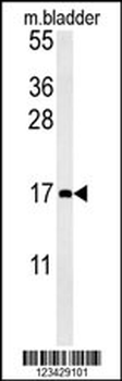 CCL4 Antibody (Center)