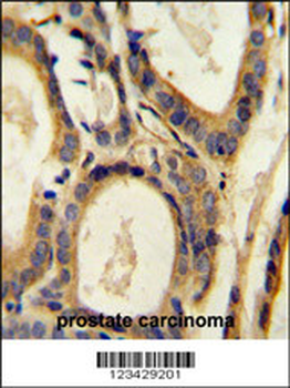 CCL4 Antibody (Center)